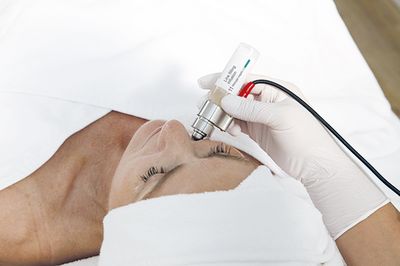 Intra Skin Infusion Behandlung mit dem DEYNIQUE Handpiece